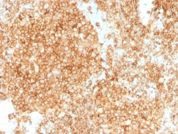 Anti-CD45 Cocktail (Leukocyte marker), clone PTPRC/1147 + PTPRC/1460