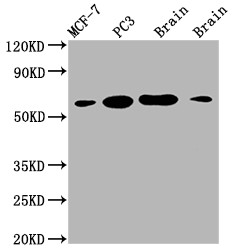 Anti-LOXL2 Recombinant Monoclonal, clone 2E5