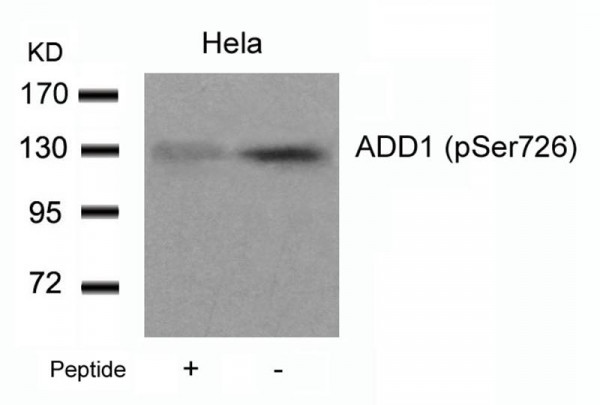 Anti-phospho-ADD1 (Ser726)