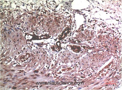Anti-MMP2, clone 1H1
