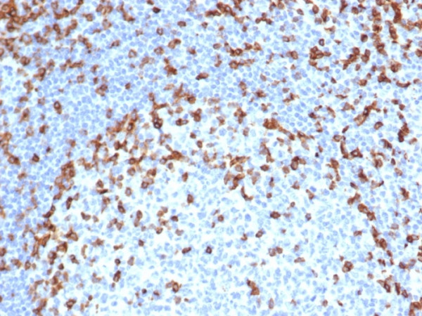 Anti-CD7 (T-Cell Leukemia Marker), recombinant antibody, clone rCD7/6387