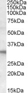 Anti-FHL2, C-terminal