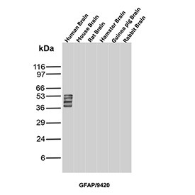 Anti-GFAP / Glial fibrillary acidic protein, clone GFAP/9420