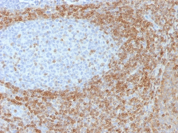 Anti-Bcl-2 (Apoptosis &amp; Follicular Lymphoma Marker), clone SPM530