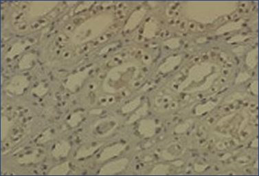 Anti-Dnmt1, clone 60B1220.1