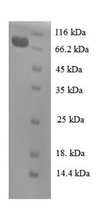 Cell division cycle protein 23 homolog (CDC23), partial, human, recombinant