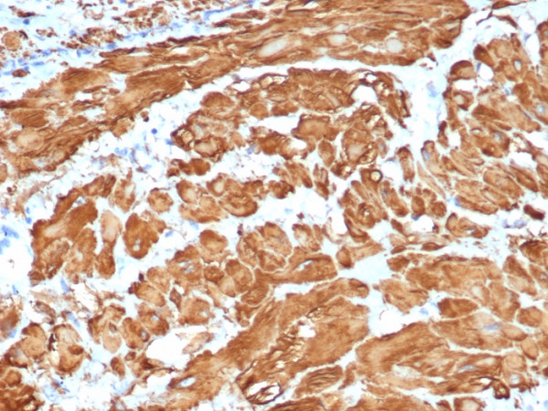 Anti-Actin, Smooth Muscle (Leiomyosarcoma Marker), recombinant antibody, clone ACTA2/1614R