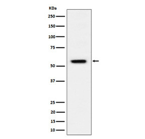 Anti-phospho-Vimentin (Ser39) / VIM, clone 31V35