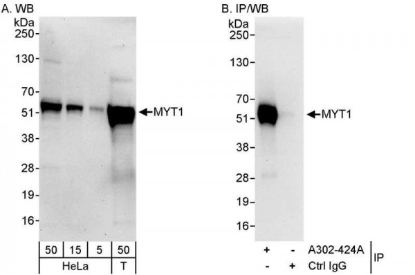 Anti-MYT1
