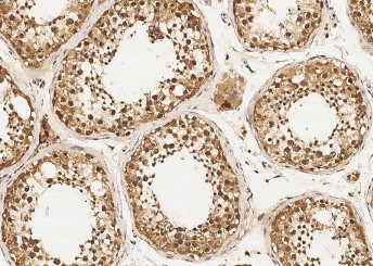 Anti-DZIP1 Monoclonal Antibody