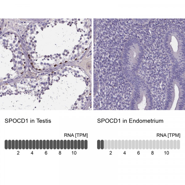 Anti-SPOCD1