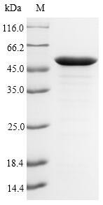 UDP-3-O-acyl-N-acetylglucosamine deacetylase (lpxC), Pseudomonas aeruginosa, recombinant