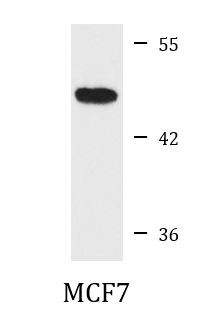 Anti-BDKRB2
