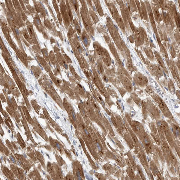 Anti-PDK1
