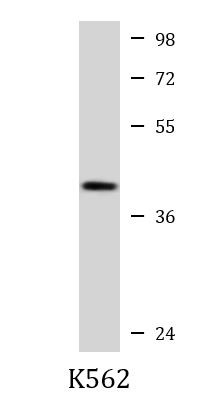 Anti-CHST11