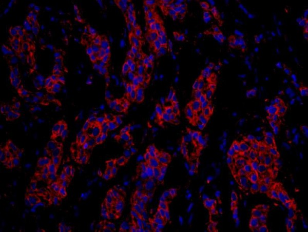 Anti-CKAP4 (IHC)