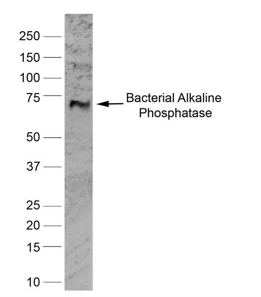 Anti-BAP / Alkaline Phosphatase (Bone), clone BGN/03/662