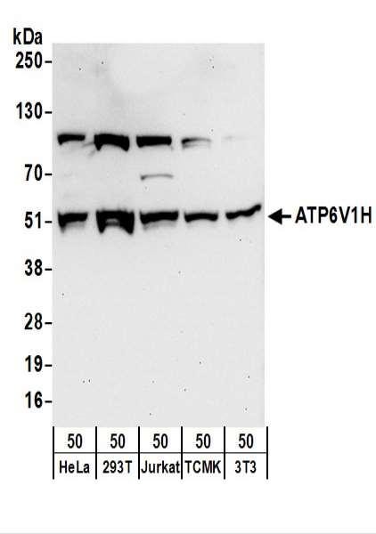 Anti-ATP6V1H