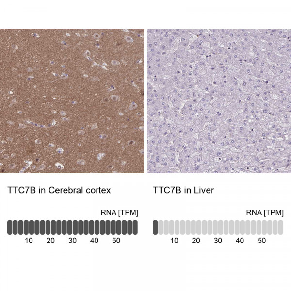Anti-TTC7B