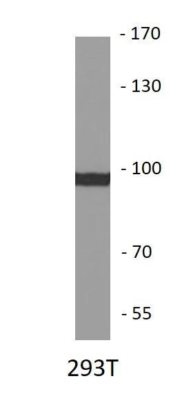 Anti-INPP4A