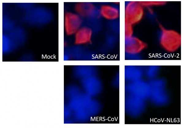 Anti-SARS-CoV / SARS-CoV-2 nucleocapsid protein antibody [SQab20177]