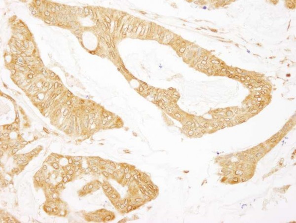 Anti-BCAR1/p130CAS (IHC)
