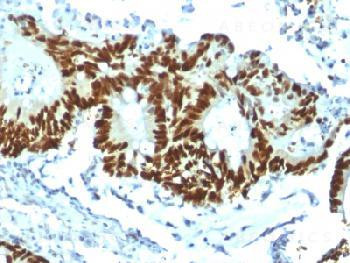 Anti-p53 Tumor Suppressor Protein(clone: TP53/1799R) (recombinant rabbit monoclonal)