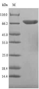 Flagellin A (flaA), partial, Campylobacter jejuni, recombinant