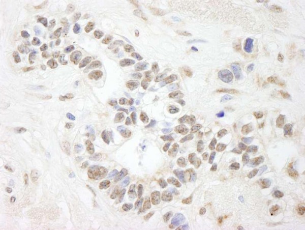 Anti-ANKS3 (IHC)