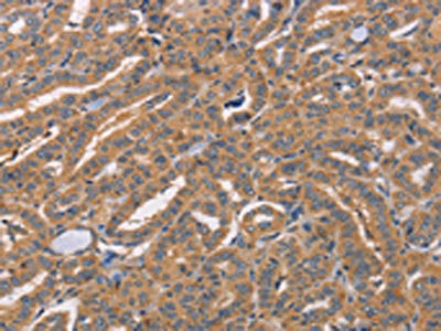 Anti-CDCA4