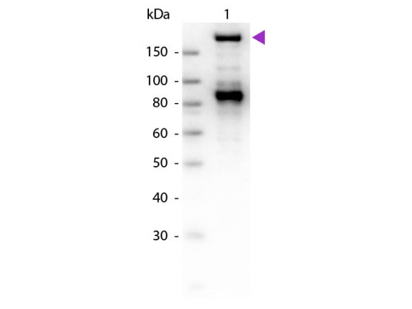 Anti-alpha-2-MACROGLOBULIN