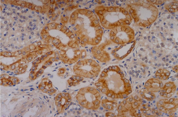 Anti-Cytokeratin 18, clone C-04