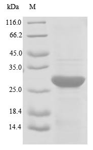 Transformer-2 protein homolog beta (TRA2B), partial, human, recombinant