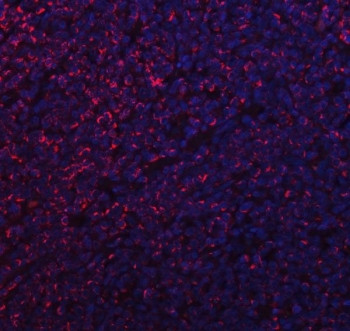 Anti-MFF / Mitochondrial fission factor