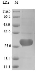 cDNA FLJ56323, highly similar to Methylated-DNA--protein-cysteinemethyltransferase (EC 2.1.1.63),par