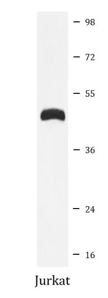 Anti-TSG101