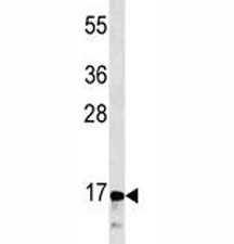 Anti-Calcitonin / CALCA / CGRP, clone 406CT21.4.3