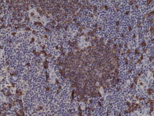 Anti-CD20 (human), Rabbit Monoclonal (RM272)