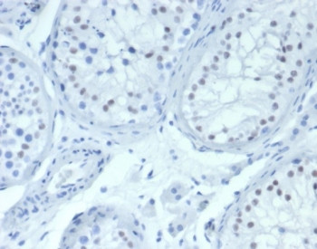 Anti-WT1 / Wilms Tumor 1, clone WT1/7452