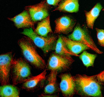 Anti-NFU1 / HIRA-interacting protein 5 / HIRIP5