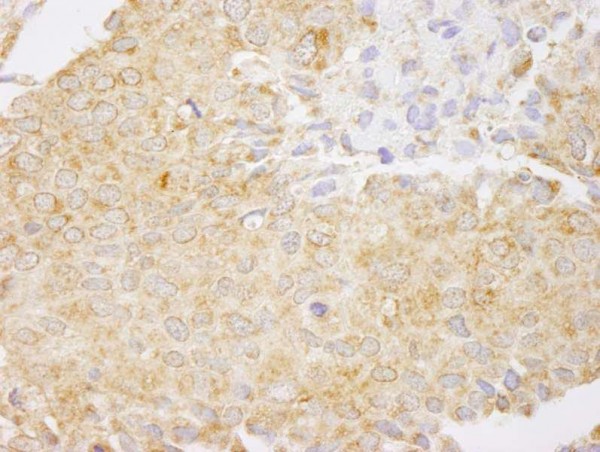 Anti-NF-kappaB1 (IHC)