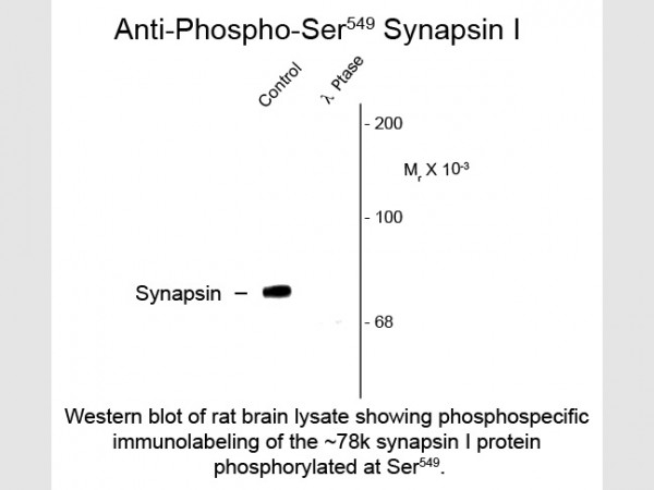 Anti-phospho-Synapsin I (Ser549)