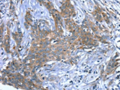 Anti-SCPEP1