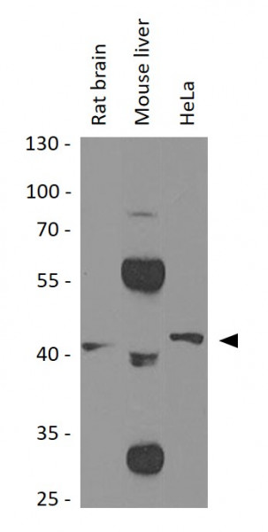 Anti-CD38