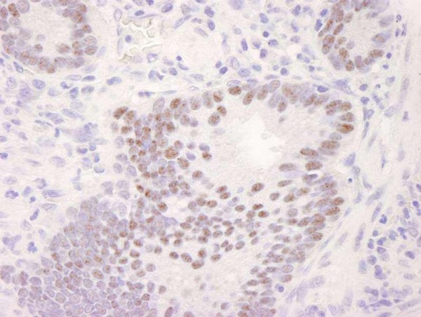 Anti-CDK11 (IHC)