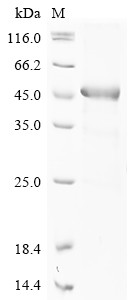 A disintegrin and metalloproteinase with thrombospondin motifs 18 (ADAMTS18), partial, human, recomb