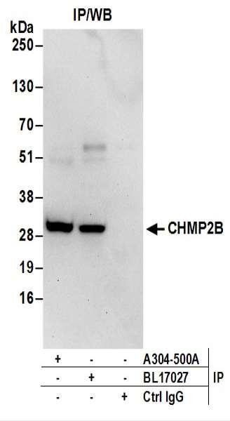 Anti-CHMP2B