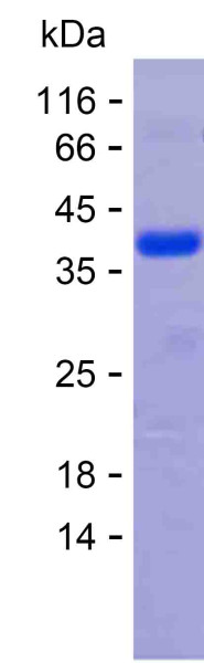 TARBP2 (human), recombinant protein