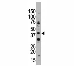 Anti-CD33