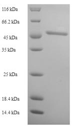 3-ketoacyl-CoA thiolase, peroxisomal (ACAA1), human, recombinant